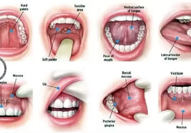 تشخیص ضایعات دهان کلینیک فتاح